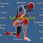 Inflammation