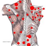 Back Knots. Back Pain. Massage Trigger Points