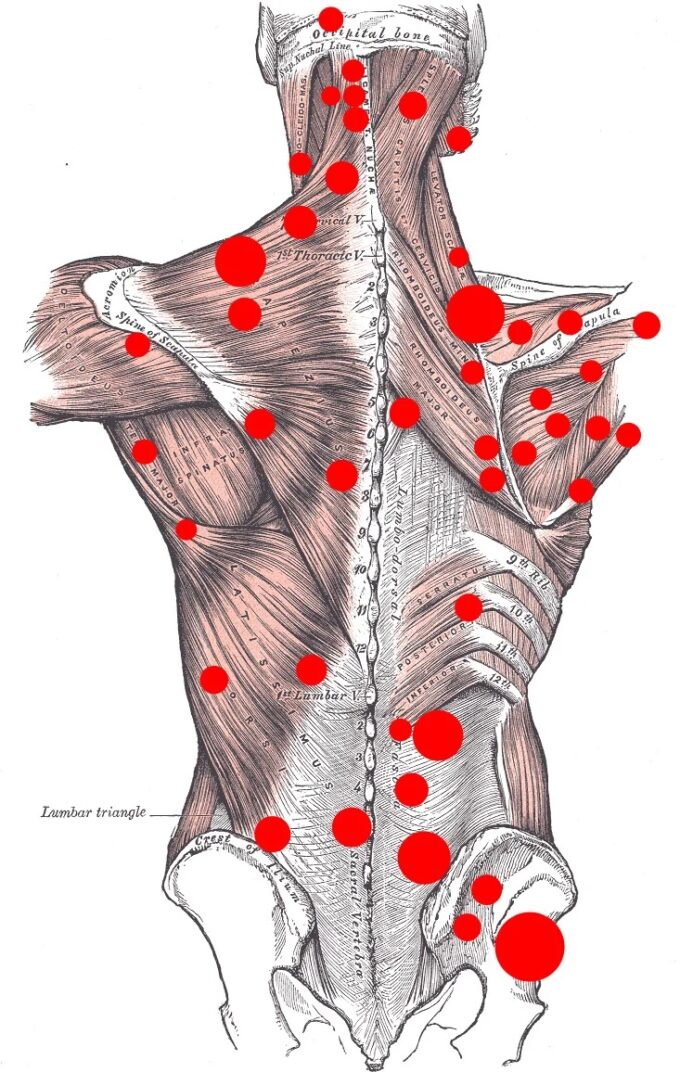 back knots. back pain. massage trigger points