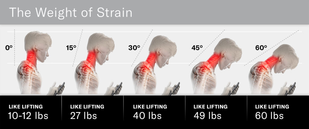 Tech Neck Shoulder Back Pain