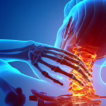 Neck Pain 2