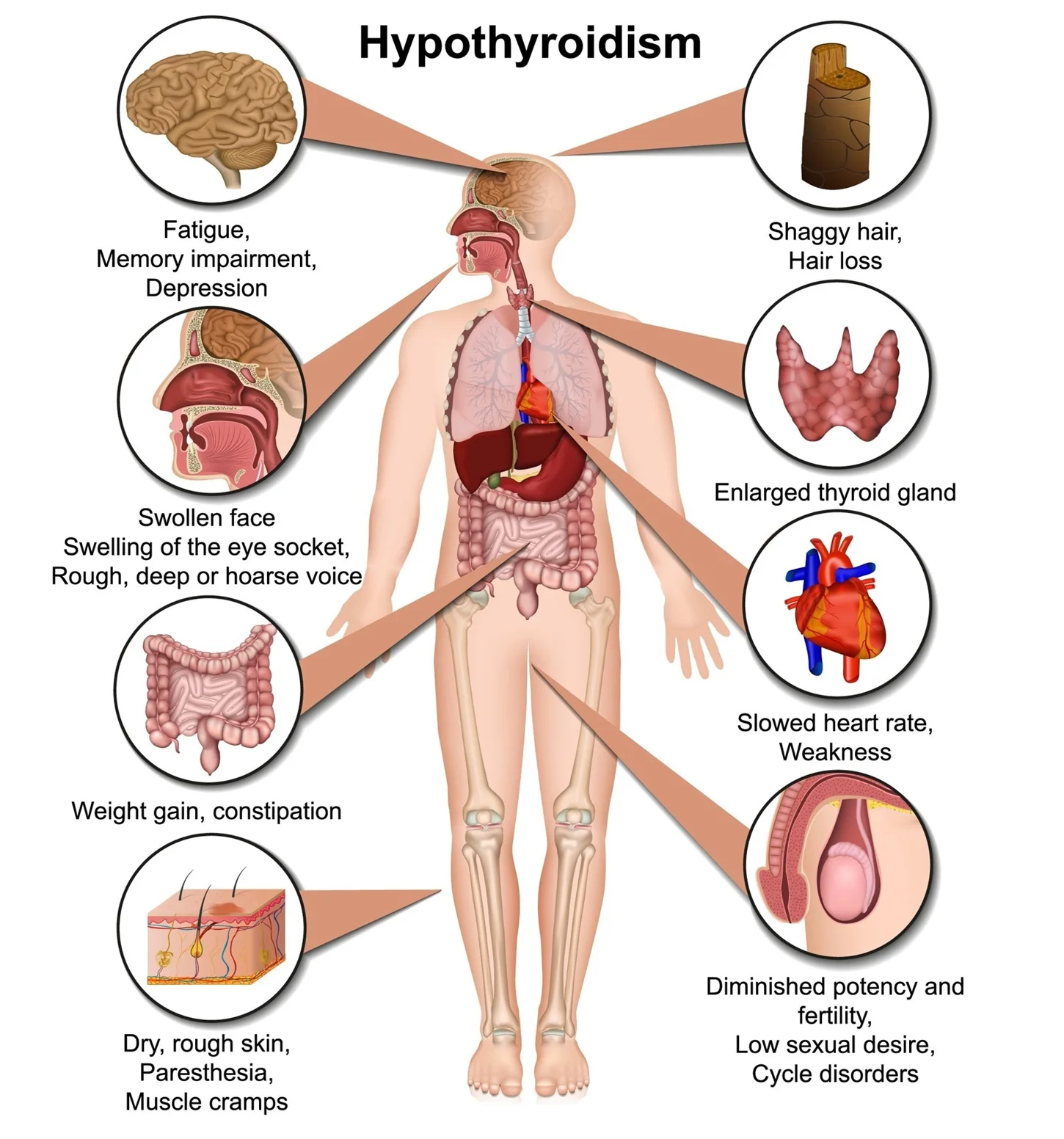 Massage Therapy Center Hypothyroidism