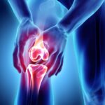 Massage Therapy Center Palo Alto Joint Problem