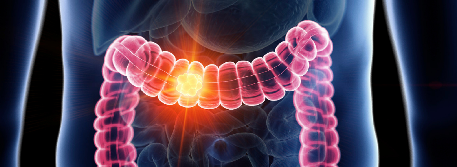 Massage Therapy Center Colorectal Cance Banner Pr