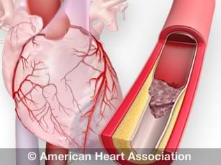 Massage Therapy Center Heart
