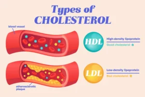 Palo Alto Massage Therapy Center Cholesterol