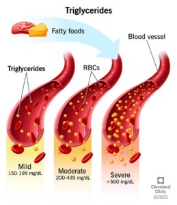 Palo Alto Massage Therapy Center Triglyceride
