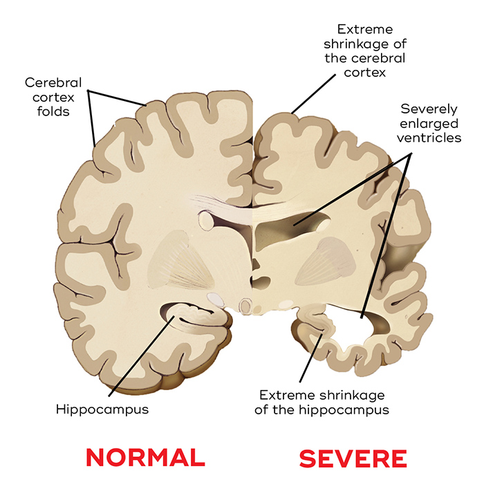 Massage Therapy Center Brain Scan 1