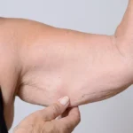 Massage Therapy Center Palo Alto Musclelossandhormonetherapy