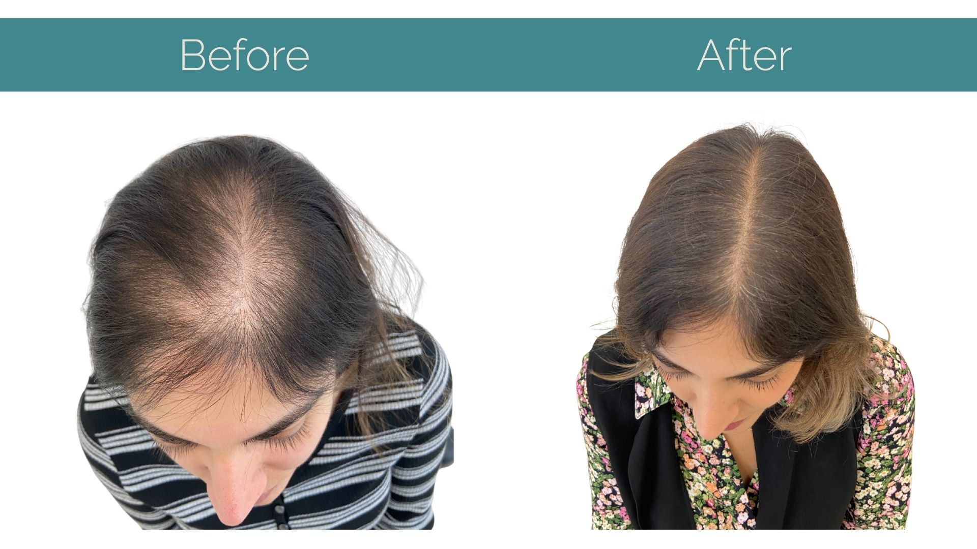 Massage Therapy Center Gentle Hair Routine